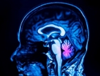Znanstvenici otkrili novu funkciju malog mozga